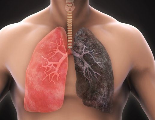 أمراض الجهاز التنفسي حقائق و أسرار 