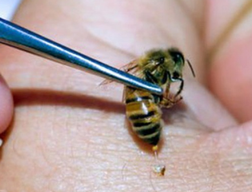 ما لا تعرفه عن  فوائد لسعة النحل