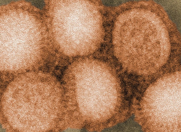 حقائق و معلومات عن الإنفلونزا الإسبانية